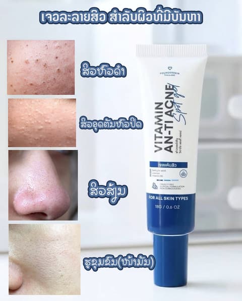 ເຈວລະລາຍສິວ Founderskin