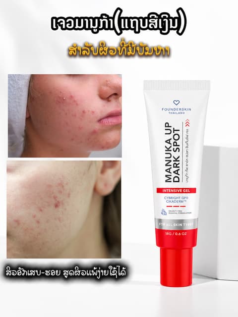 ເຈວມານູກ້າ Founderskin
