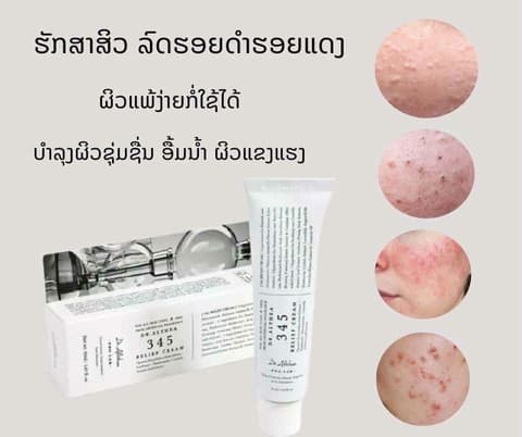 ຄີມມ້ອຍ 345