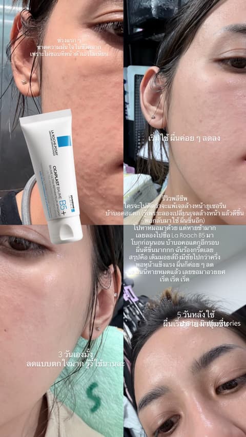 ບາມບຳລຸງຜິວ La Roche-Posay Cicaplast Baume B5+.