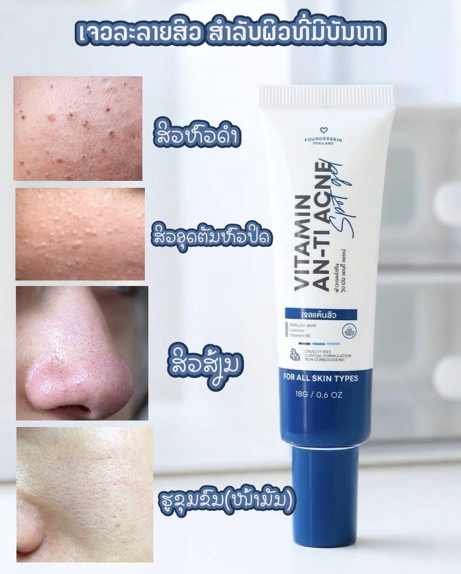 ເຈວລະລາຍສິວ Founderskin — 1