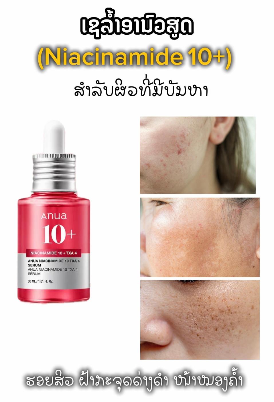 Anuaເຊລ້ຳNiacinamide — 1