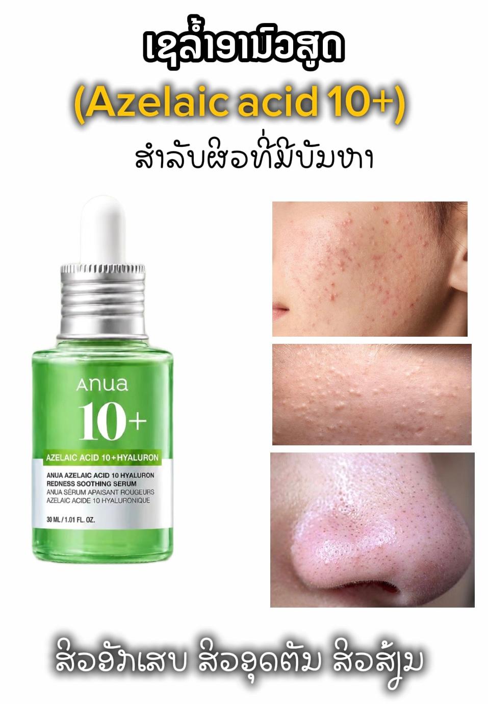 ເຊລ້ຳAnua azelaic acid — 1