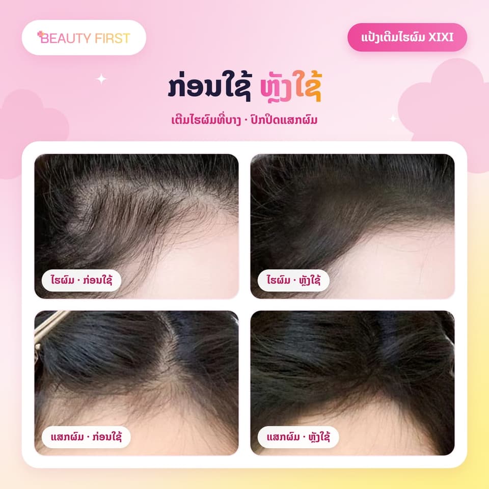 XIXI Hair Shadow ແປ້ງເຕີມໄຮຜົມ ແລະ ແສກຜົມ ເນື້ອແມັດ ກັນນ້ຳ ກັນເຫື່ອ ຕິດທົນ ເຊດເງົາບັງໜ້າຜາກກວ້າງໄດ້ຢ່າງເປັນທຳມະຊາດ — 3