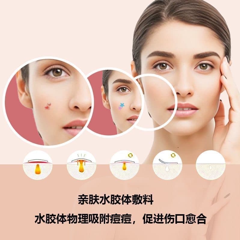 ແຜ່ນແປະສິວຮູບດາວ ACNE PATCH (51ດວງ ແຜ່ນ) – ແຜ່ນແປະສິວໄຮໂດຣຄໍລອຍ (Hydrocolloid) ຮູບດາວສຸດນ່າຮັກ, ຊ່ວຍປົກປິດຮອຍ, ດູດໜອງ, ຫຼຸດການອັກເສບ ແລະ ຮັກສາສິວ. ໃຊ້ໄດ້ທັງກາງເວັນ ແລະ ກາງຄືນ, ເໝາະສຳລັບນັກຮຽນ-ນັກສຶກສາ — 4