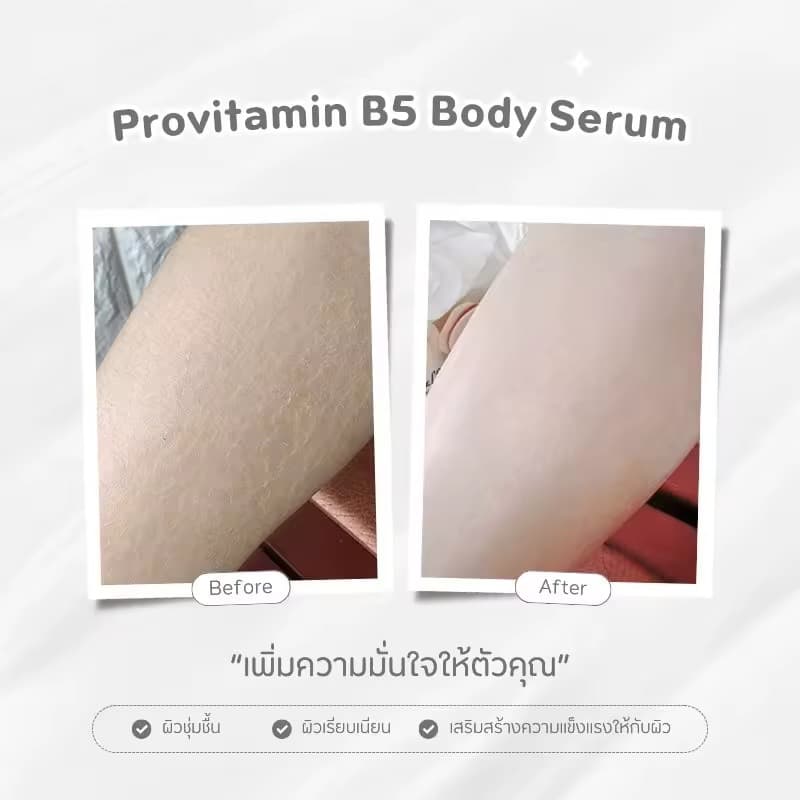 ໂລຊັ່ນທາຜິວ — 9