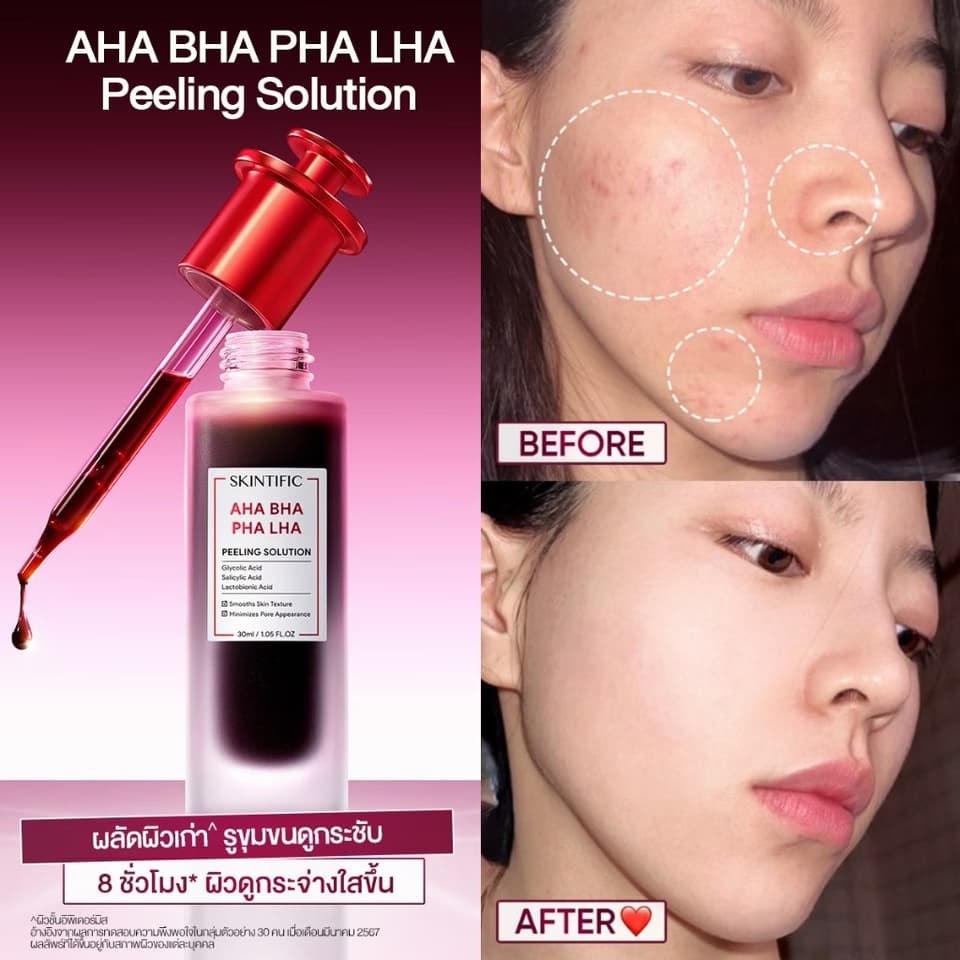 ມາດເເດງ ສະກິນທິຟິກ SKINTIFIC AHA BHA PHA LHA PEELING SOLUTION — 3